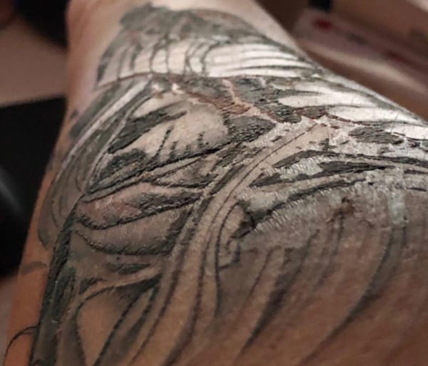 tatuagem descascando é normal ou preocupante