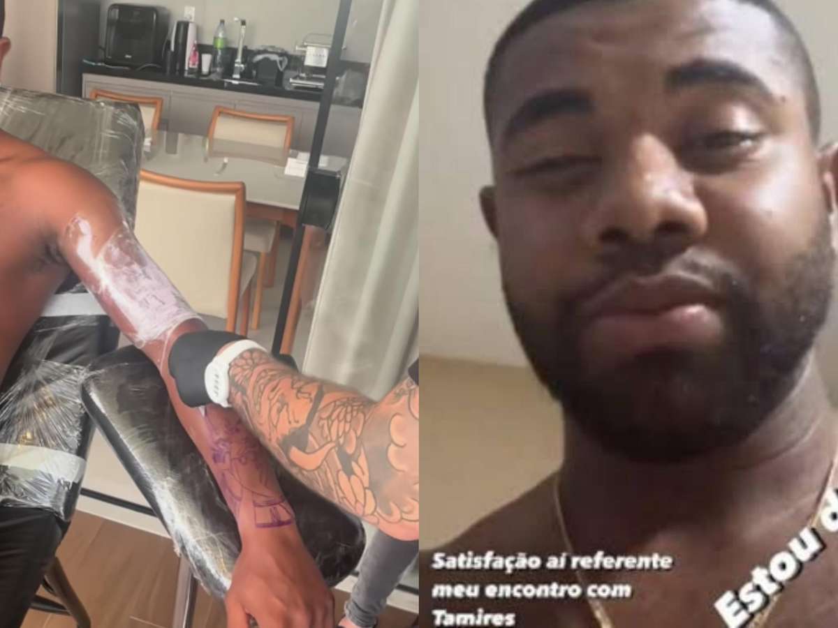 como aliviar inchaço de tatuagem inflamada rapidamente