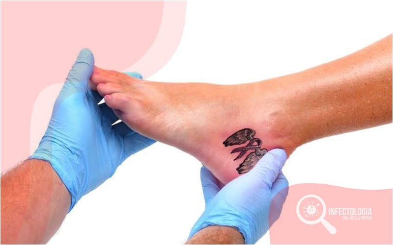 tatuagem inflamada vs infeccionada qual a diferença