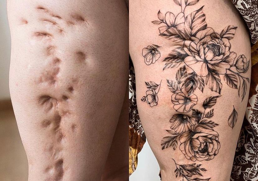 tatuagem cover-up preto e cinza