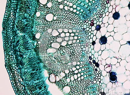 Terapia com Células-Tronco vs. Transplante Capilar: Qual a Melhor Opção?