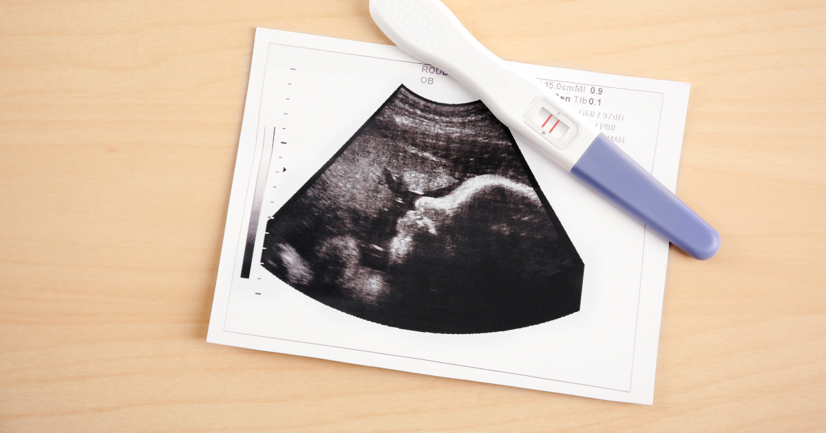 Mitos e Verdades sobre Testes de Gravidez Caseiros