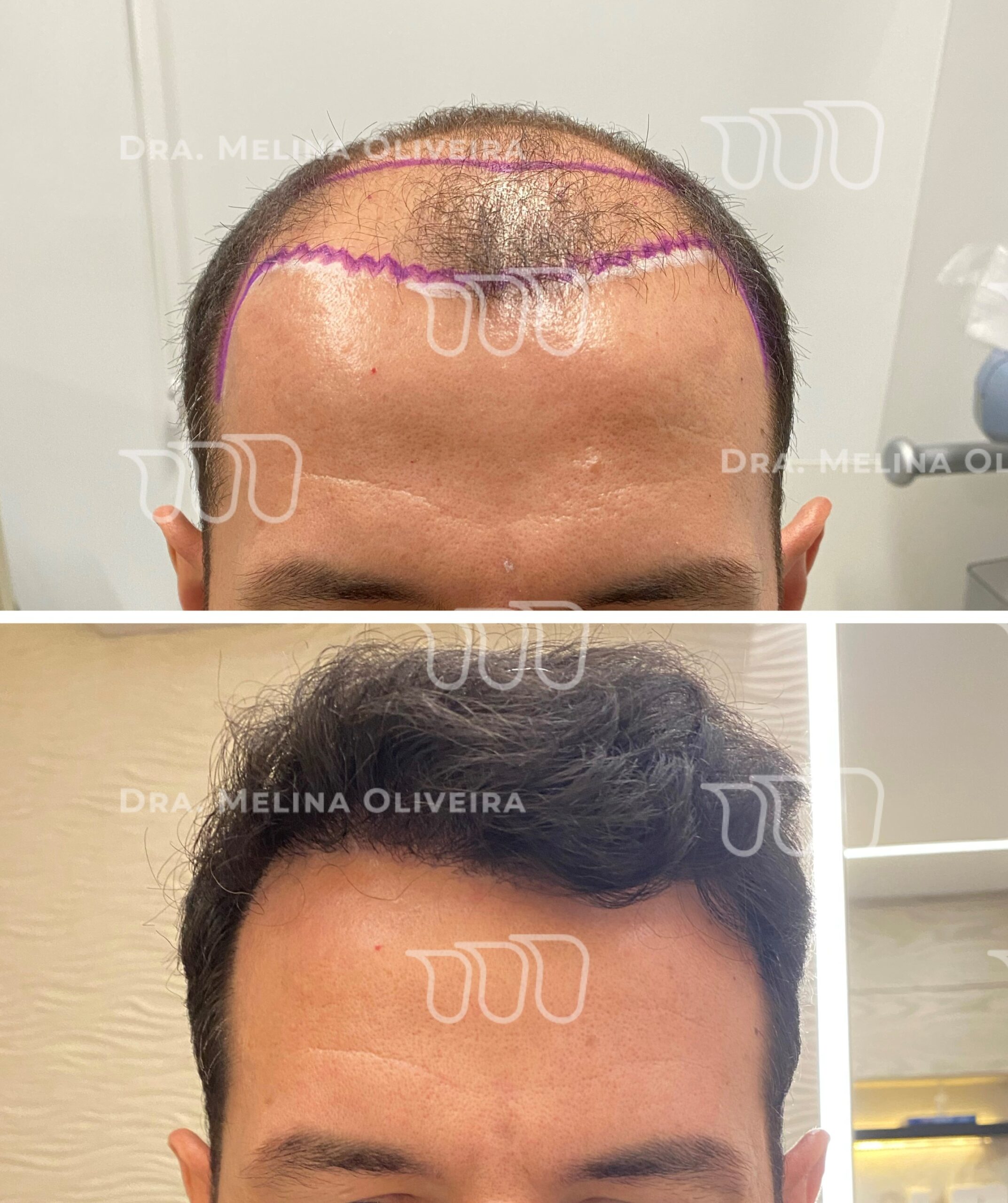 Tratamento capilar em Diadema valor