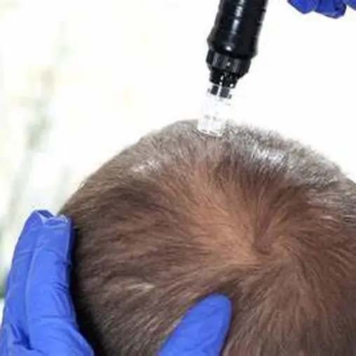 Tratamento capilar em Diadema valor