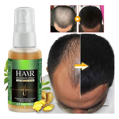 Tratamento capilar em Diadema valor