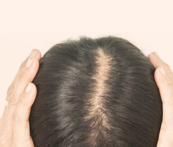 5 ideias de títulos:
1. Guia Completo: Tratamentos para Queda de Cabelo em Anápolis
2. Transplante Capilar em Anápolis: Opções e Especialistas
3. Tricologia Integrativa: A Nova Fronteira no Tratamento Capilar em Anápolis
4. Dermatologia Capilar em Anápolis: Diagnóstico e Soluções
5. Ozonioterapia Capilar: Benefícios e Onde Encontrar em Anápolis