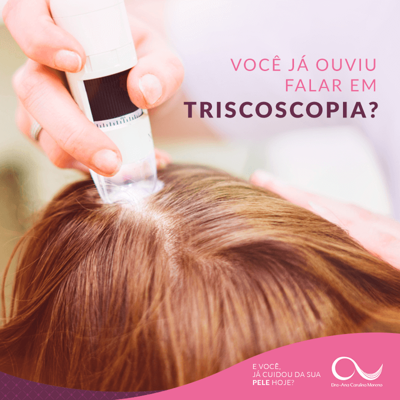 Tratamento de queda de cabelo em Anápolis