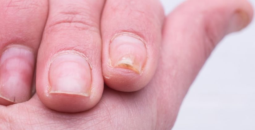 Alimentos para Fortalecer Unhas Quebradiças