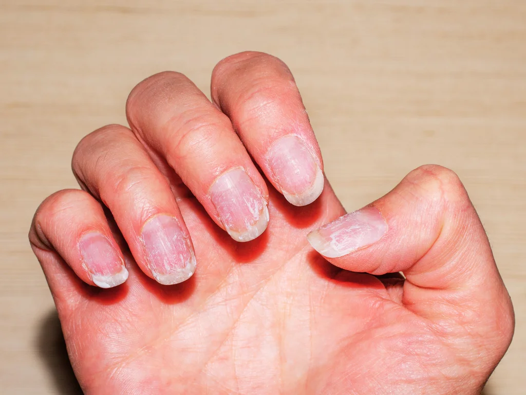 Melhores Cremes e Óleos para Unhas Ressecadas