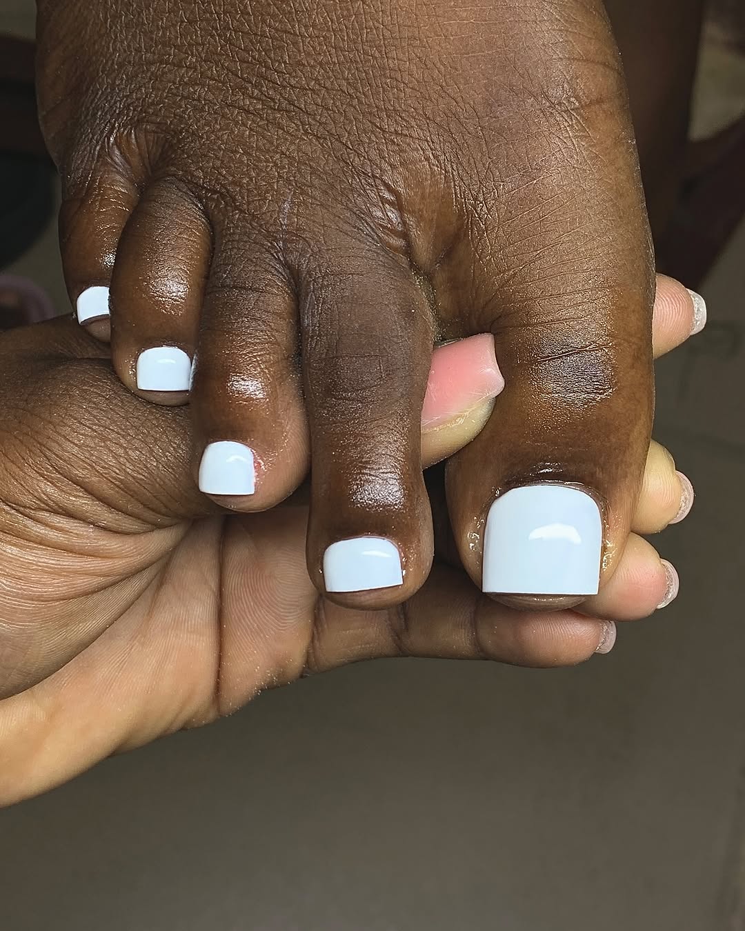 Como tratar manchas brancas nas unhas dos pés