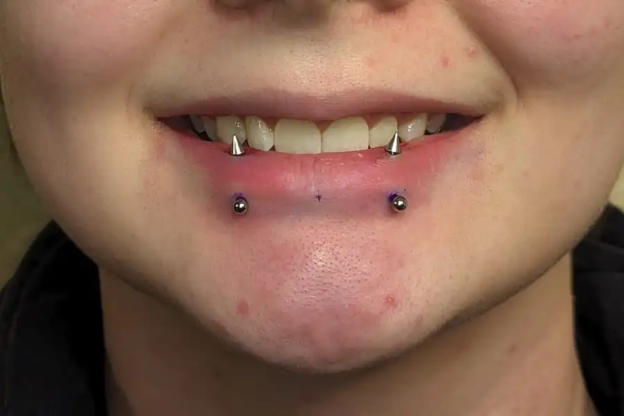 vertical labret piercing oral health