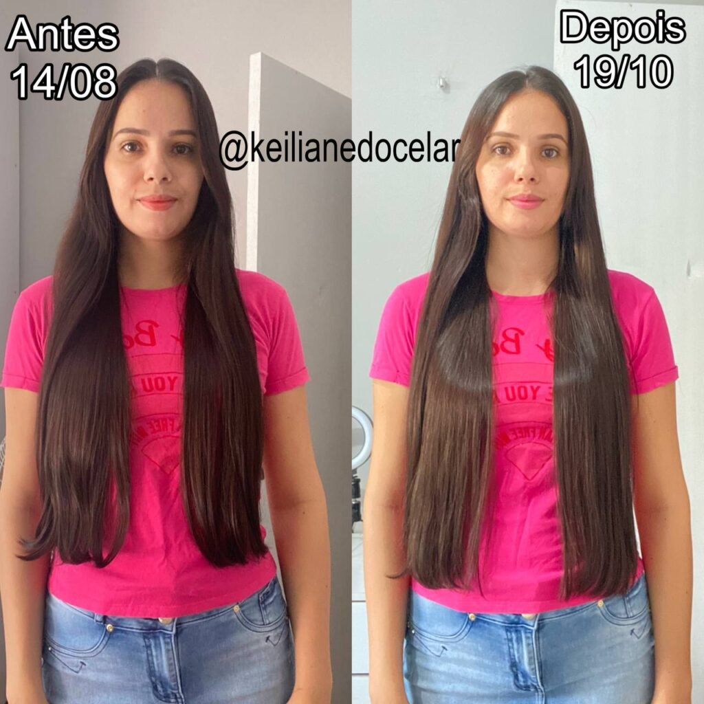 Suplementos Capilares: Qual Escolher entre Forever Hair, New Hair e Pilopeptan?