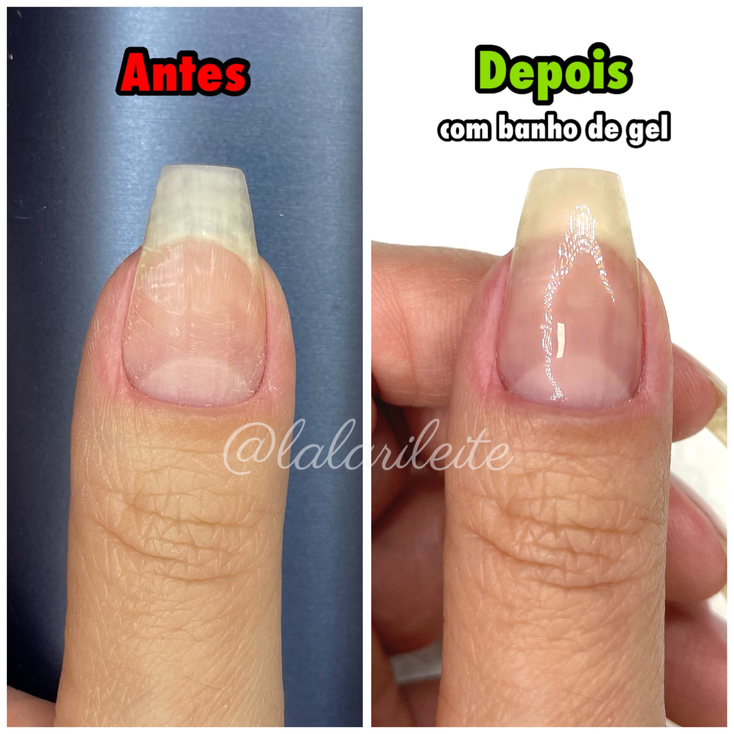 gel fortalecedor
