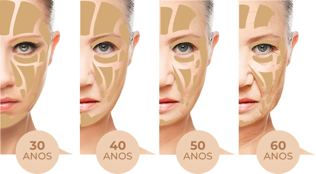bioestimulador de colágeno antes e depois