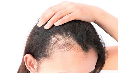 tratamento caseiro para queda de cabelo