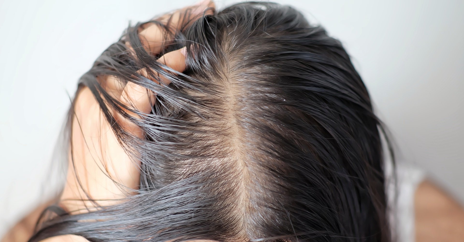 cabelo oleoso na raiz e seco nas pontas como tratar