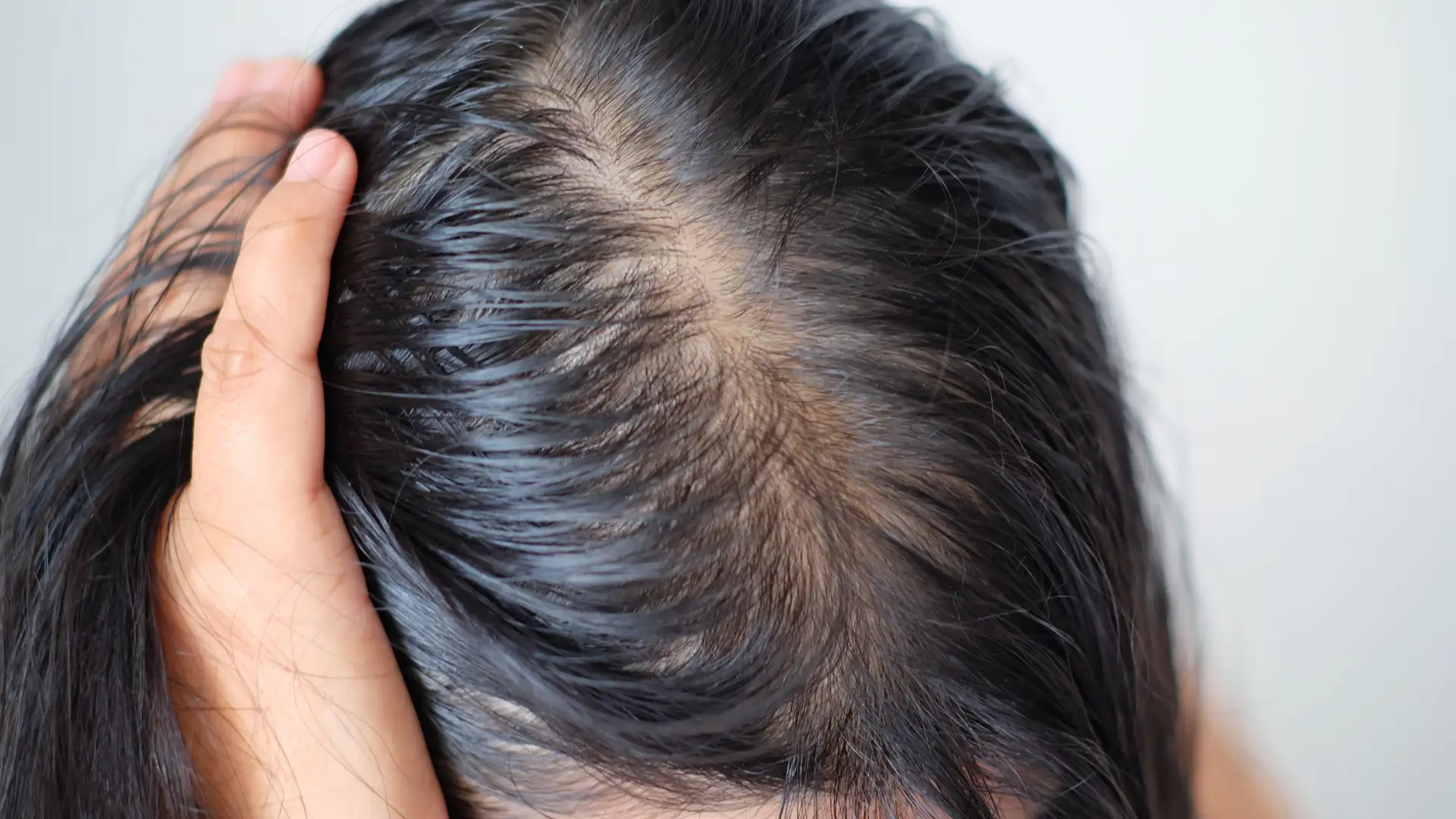 como tirar oleosidade do cabelo rapido