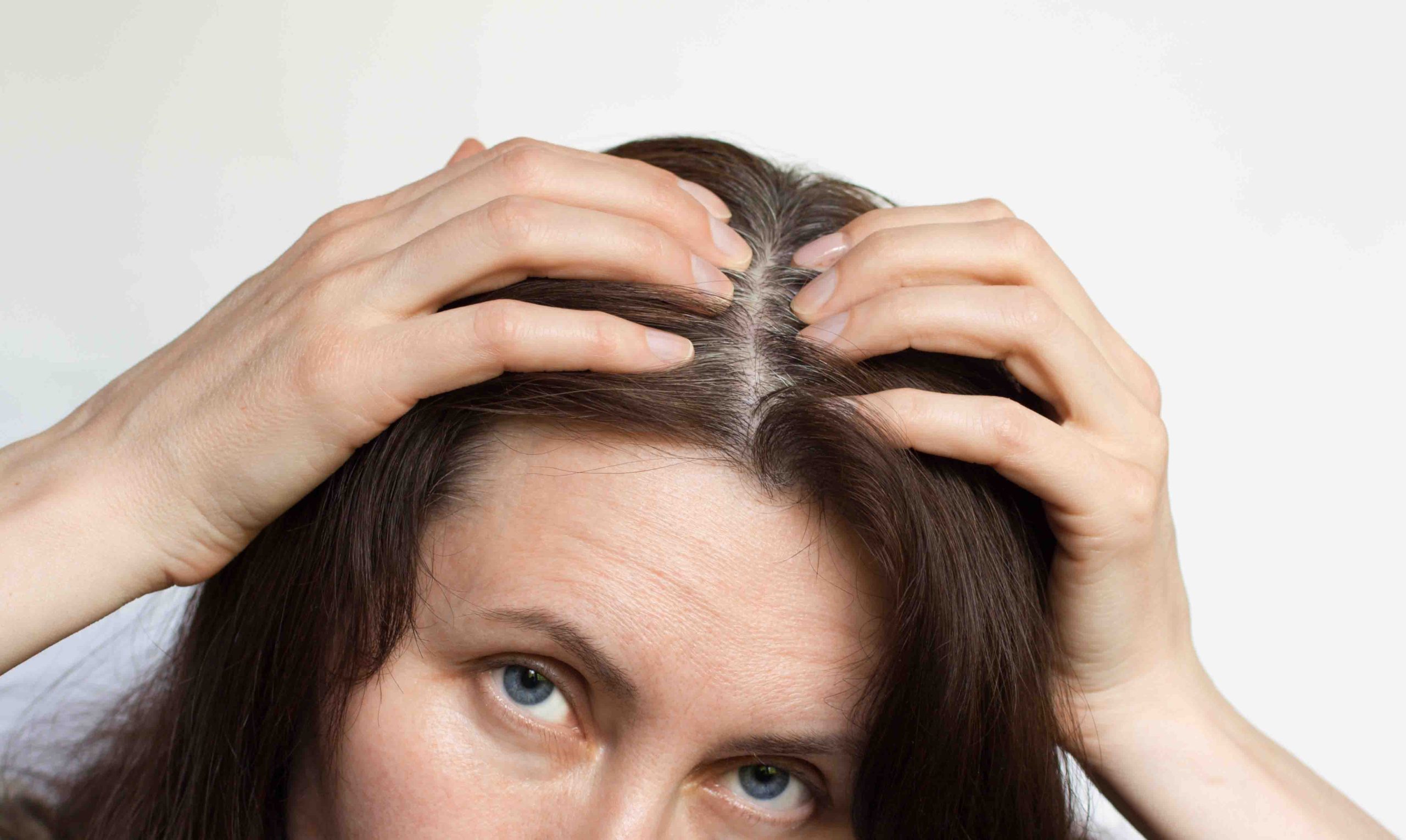 como tirar oleosidade do cabelo rapido