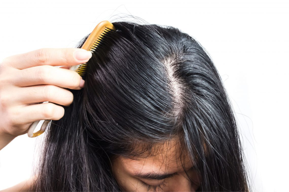 como tirar oleosidade do cabelo rapido