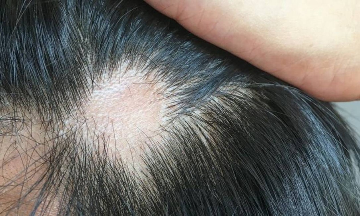 cabelo caindo muito ao lavar