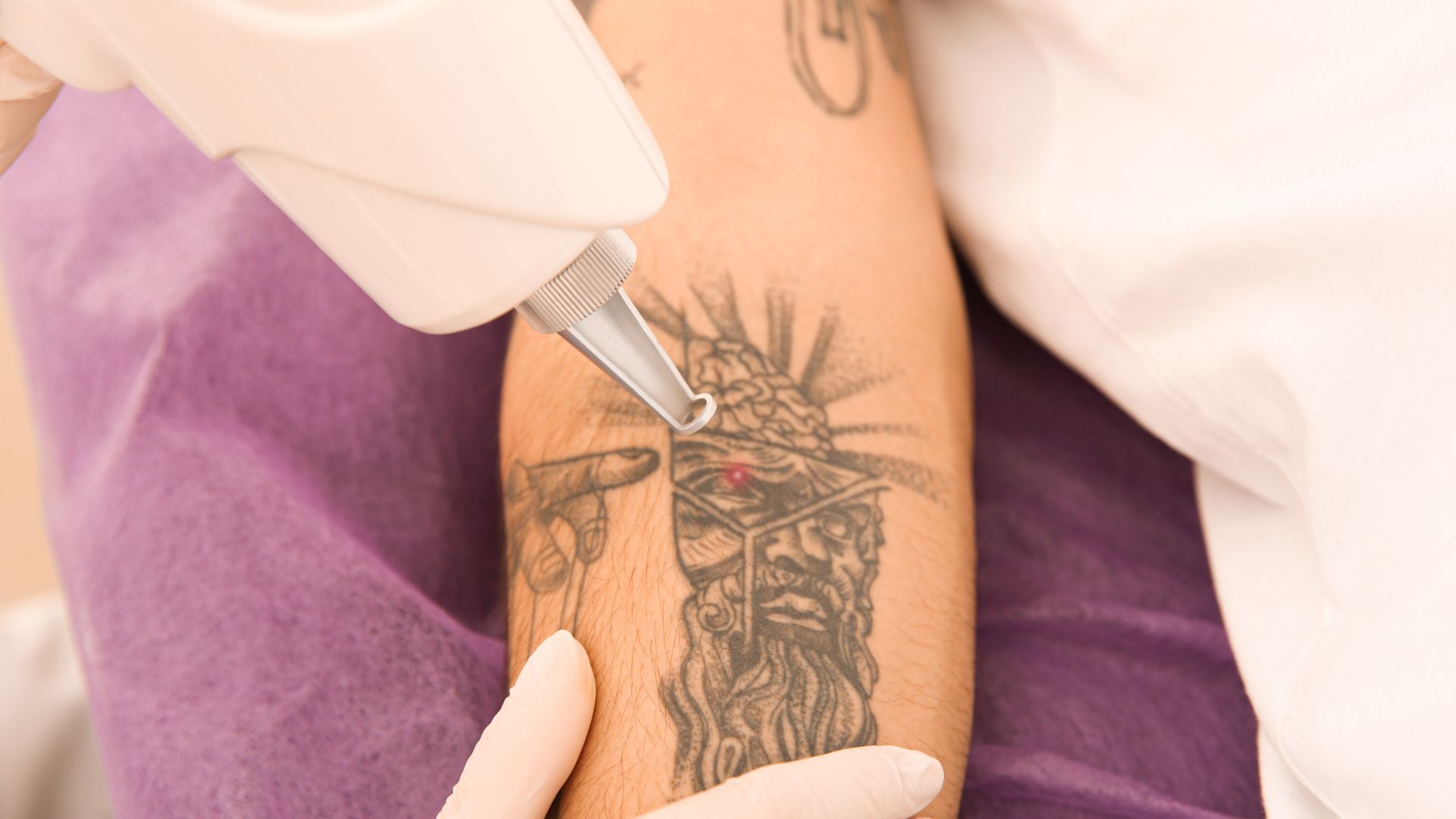 quanto custa tatuagem fineline braço