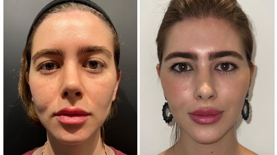 inchaço facial o que fazer