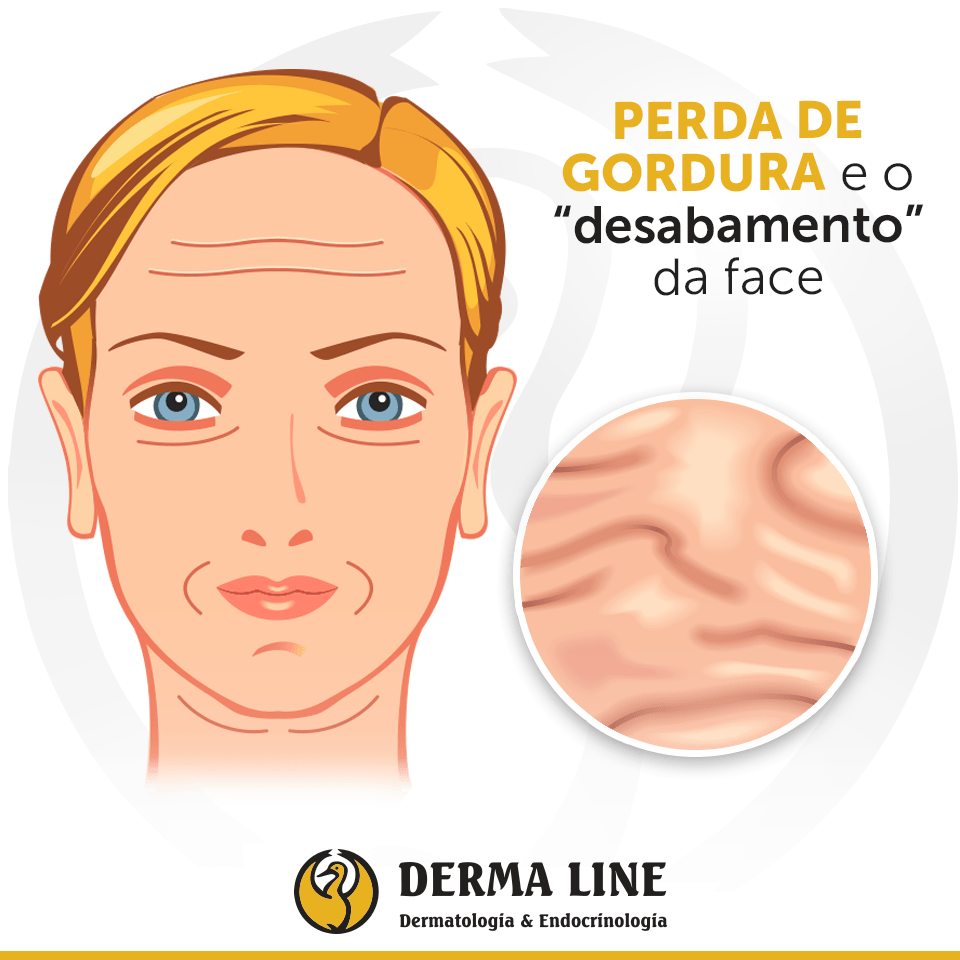 cortisol e rosto inchado