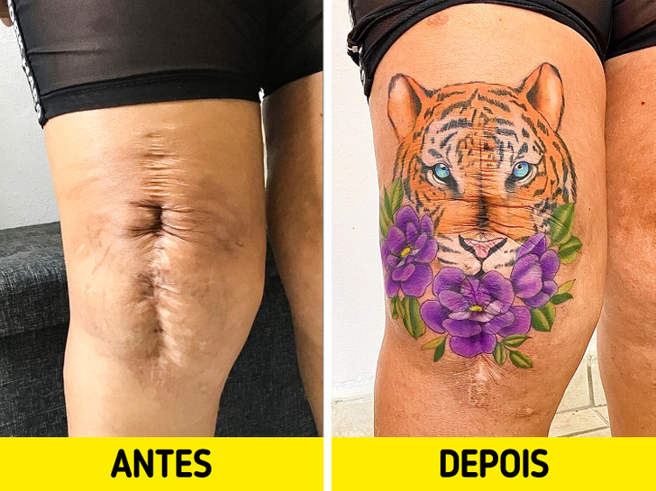 melhores desenhos de tatuagem para cicatrizes