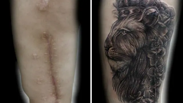 tatuagem freehand em cicatriz