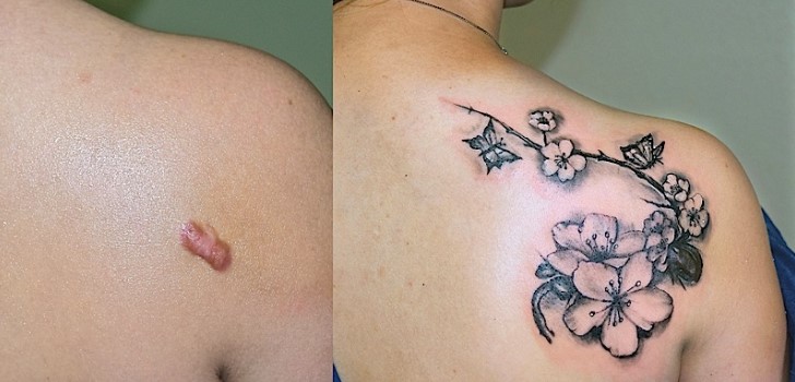 tatuagem nas costas para disfarçar marcas