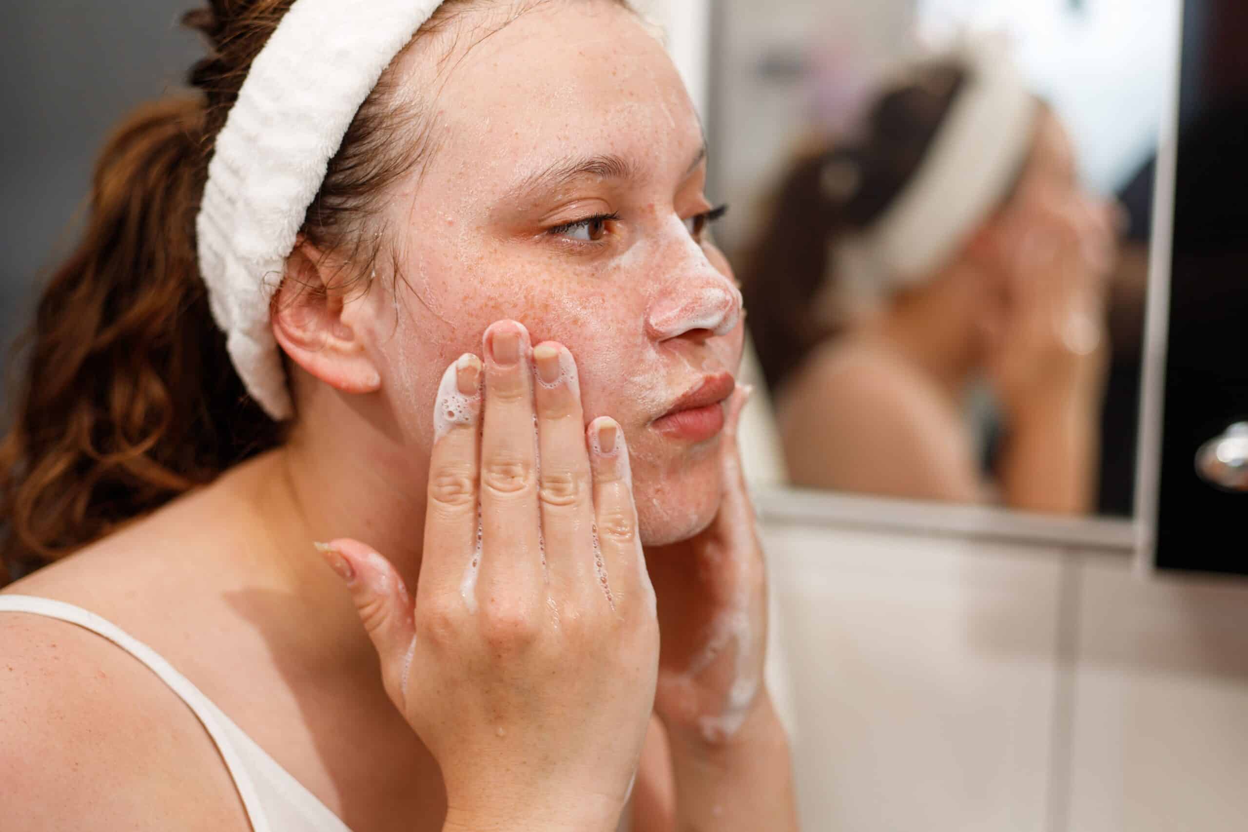 limpeza de pele para acne